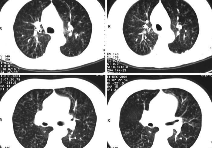 房卡必备教程“微信链接牛牛房卡怎么弄”详细房卡教程